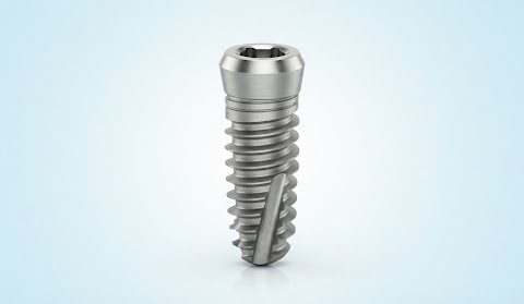 Протокол All-on-4 — фото системы